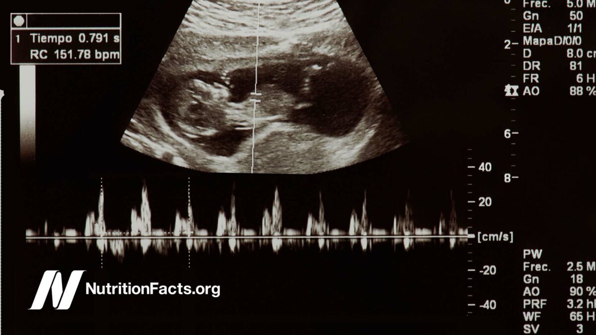 ultrasound of fetus