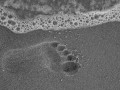 9. Preventing Gout Attacks with Diet