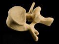 Almonds for Osteoporosis