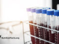 vials of blood