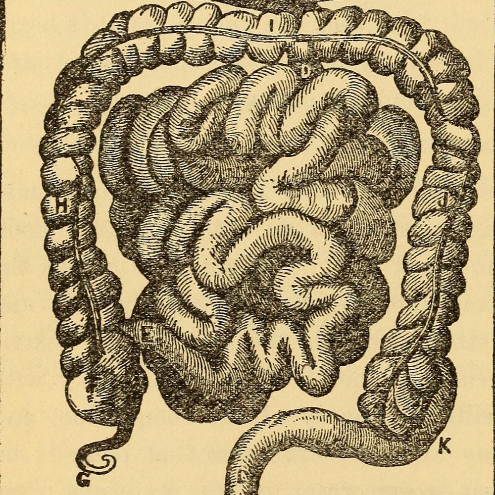 Colon Cancer