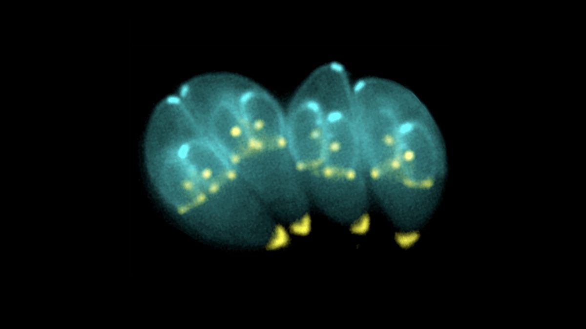 Toxoplasmosis, A Manipulative Foodborne Brain Parasite